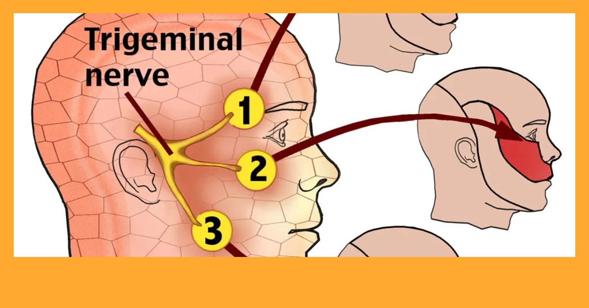 Understanding Trigeminal Neuralgia: Causes, Symptoms, and Treatments