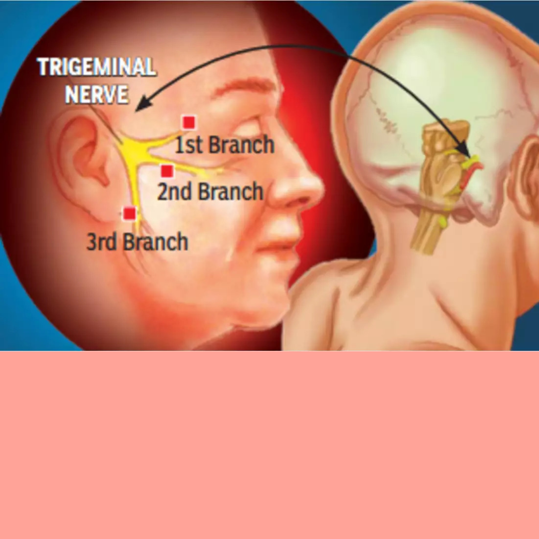 Finding the Best Trigeminal Neuralgia Treatment in California – Expert Tips and Resources